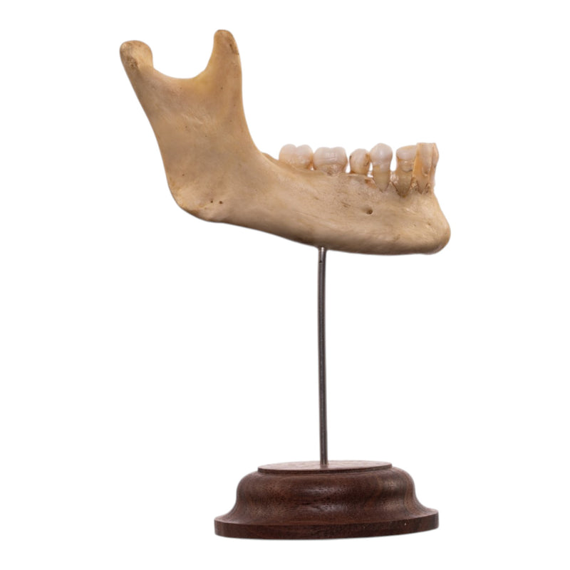 Real Human Partial Mandible