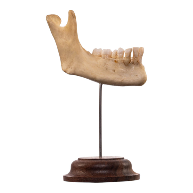 Real Human Partial Mandible