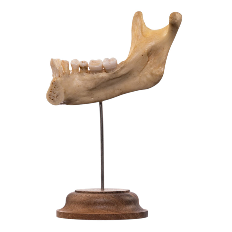Real Human Partial Mandible