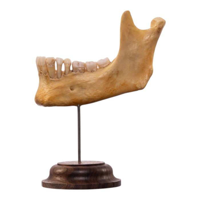 Real Human Partial Mandible