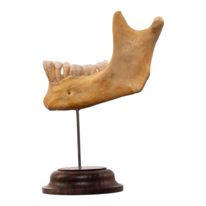 Real Human Partial Mandible