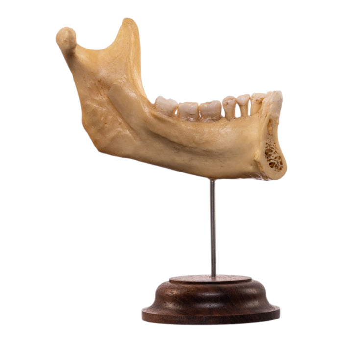 Real Human Partial Mandible