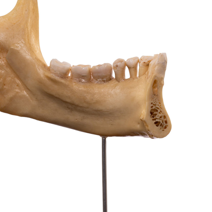 Real Human Partial Mandible