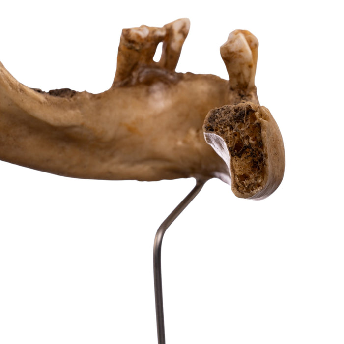 Real Human Partial Mandible - Antique