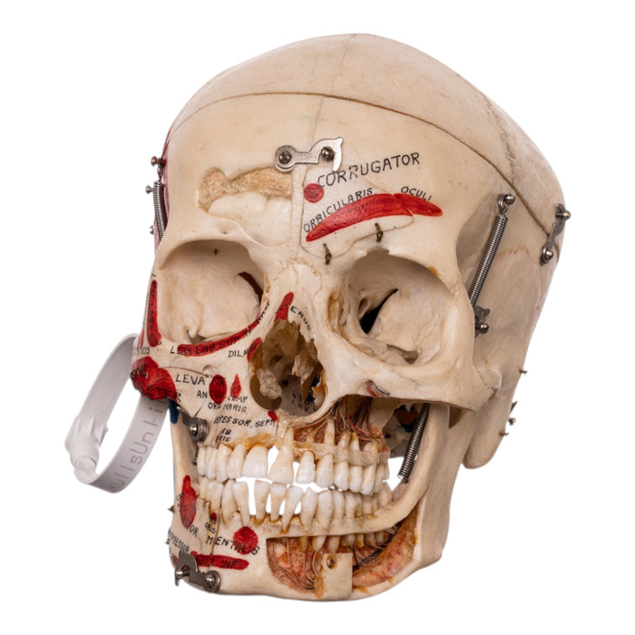 Real Human Dissected Skull in Carrying Case