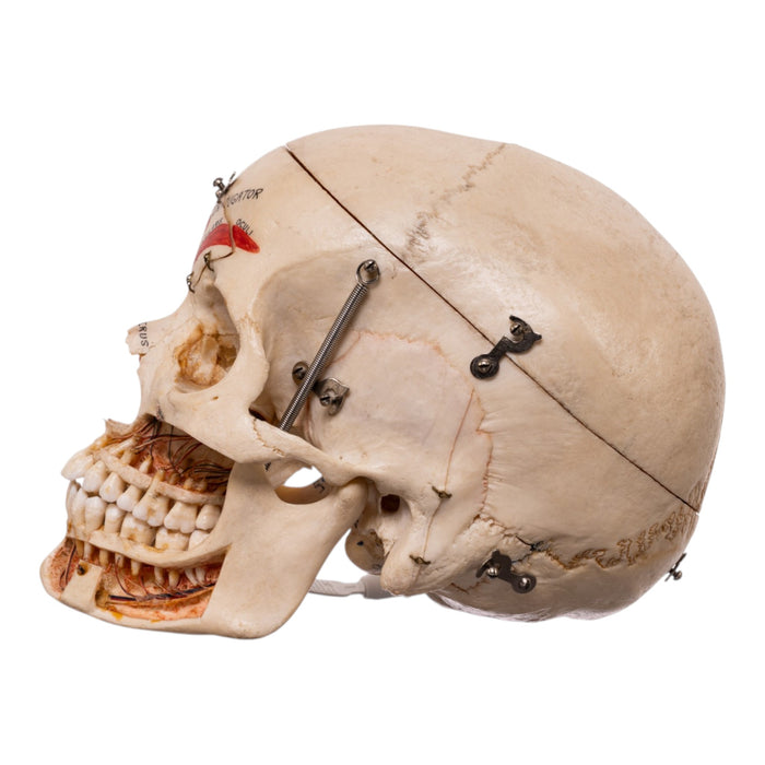 Real Human Dissected Skull in Carrying Case