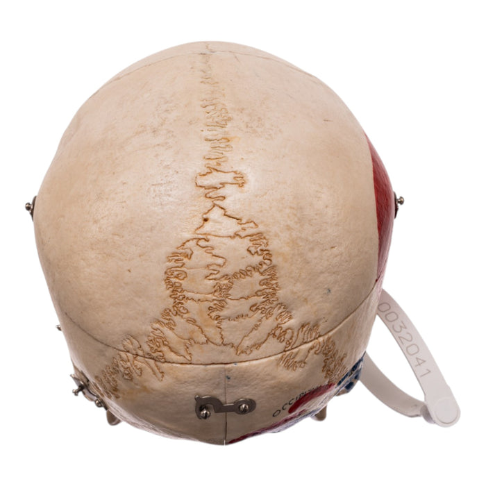 Real Human Dissected Skull in Carrying Case