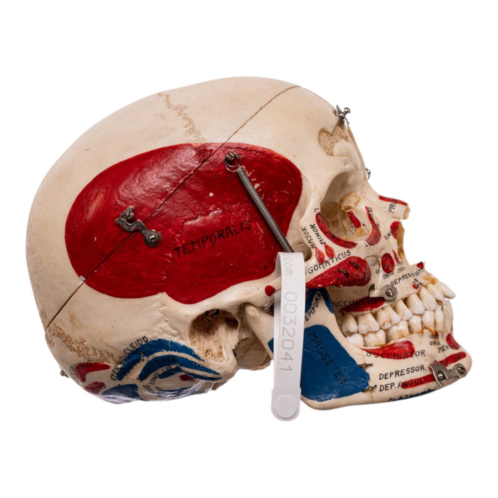 Real Human Dissected Skull in Carrying Case