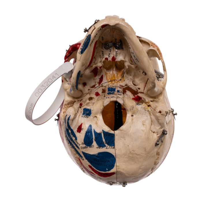 Real Human Dissected Skull in Carrying Case