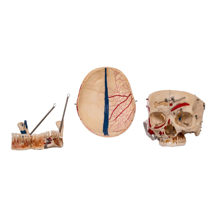 Real Human Dissected Skull in Carrying Case
