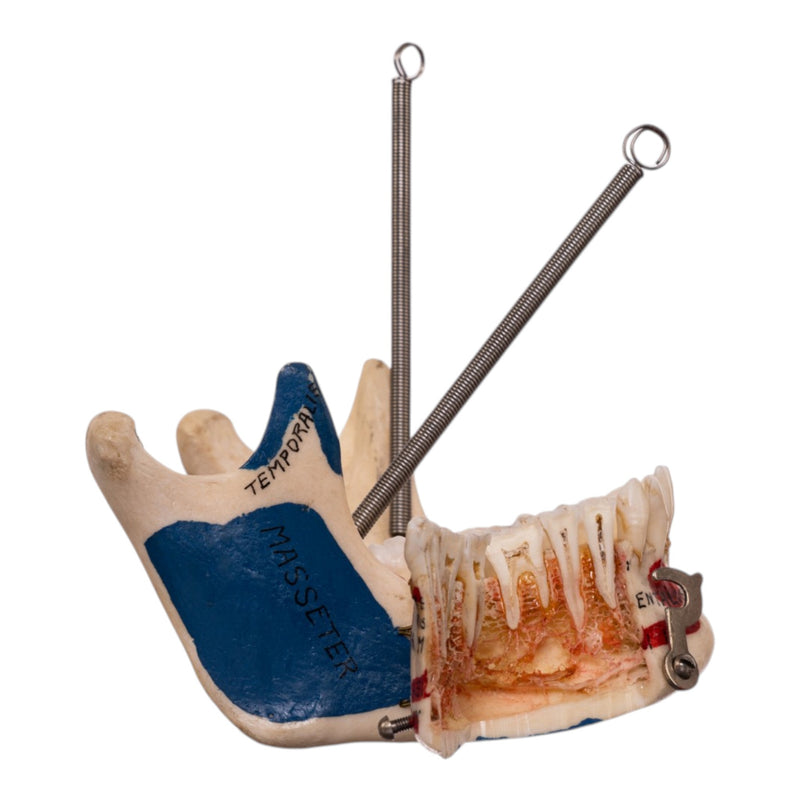 Real Human Dissected Skull in Carrying Case
