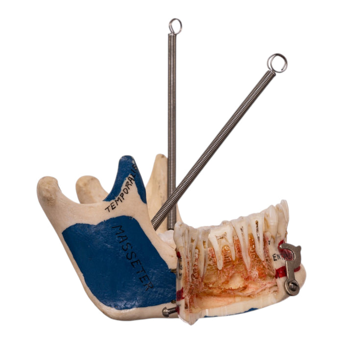 Real Human Dissected Skull in Carrying Case