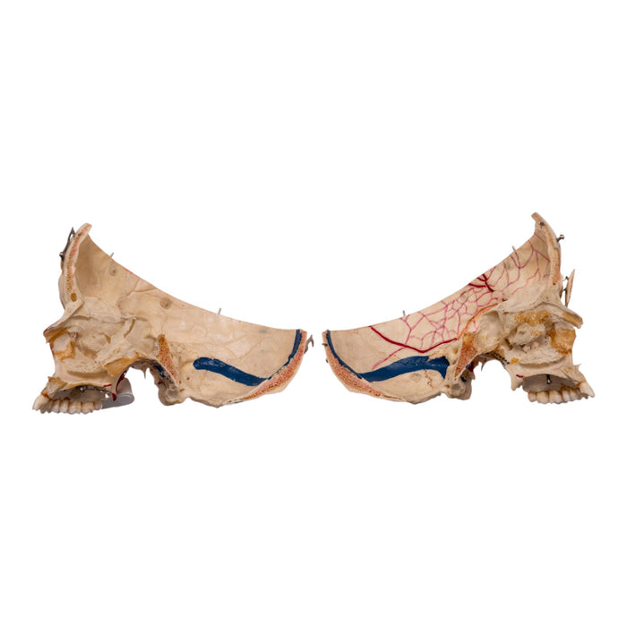 Real Human Dissected Skull in Carrying Case