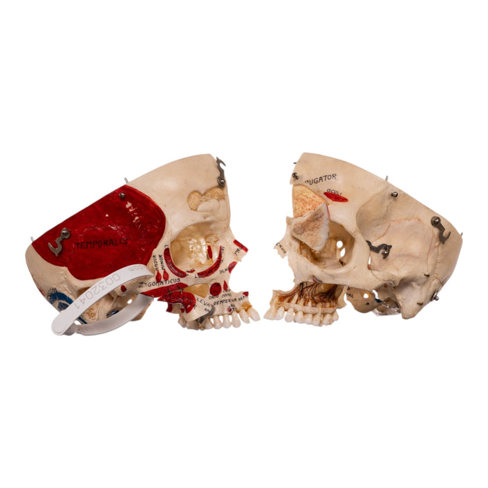 Real Human Dissected Skull in Carrying Case