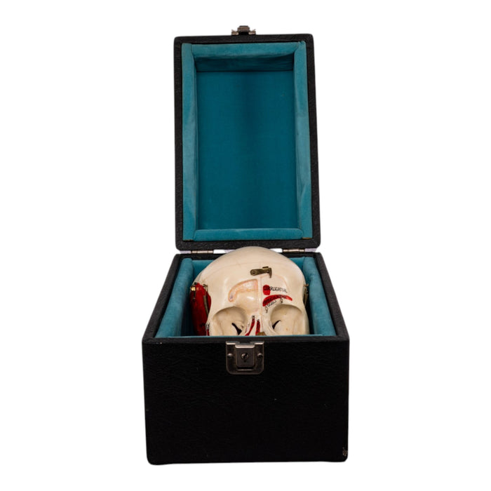 Real Human Dissected Skull in Carrying Case