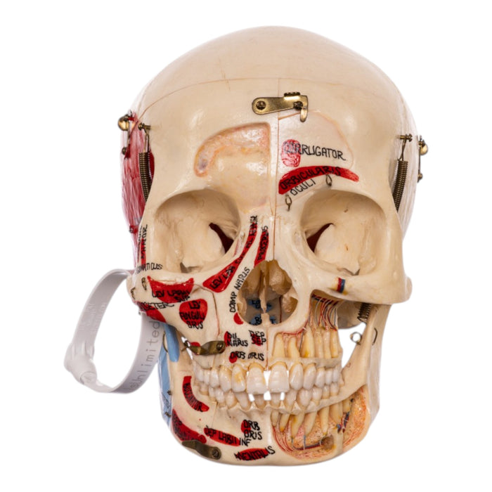 Real Human Dissected Skull in Carrying Case