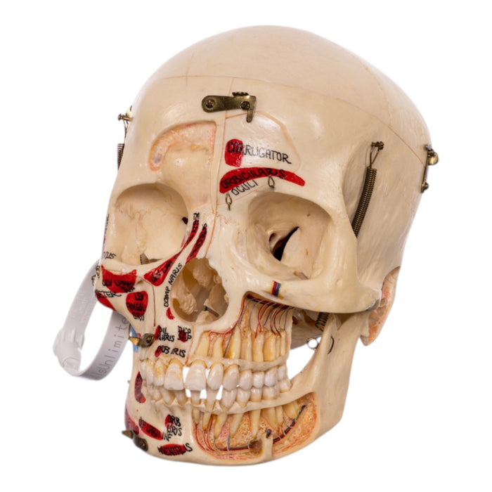 Real Human Dissected Skull in Carrying Case