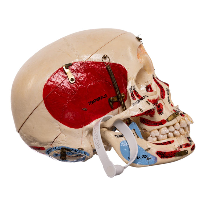 Real Human Dissected Skull in Carrying Case