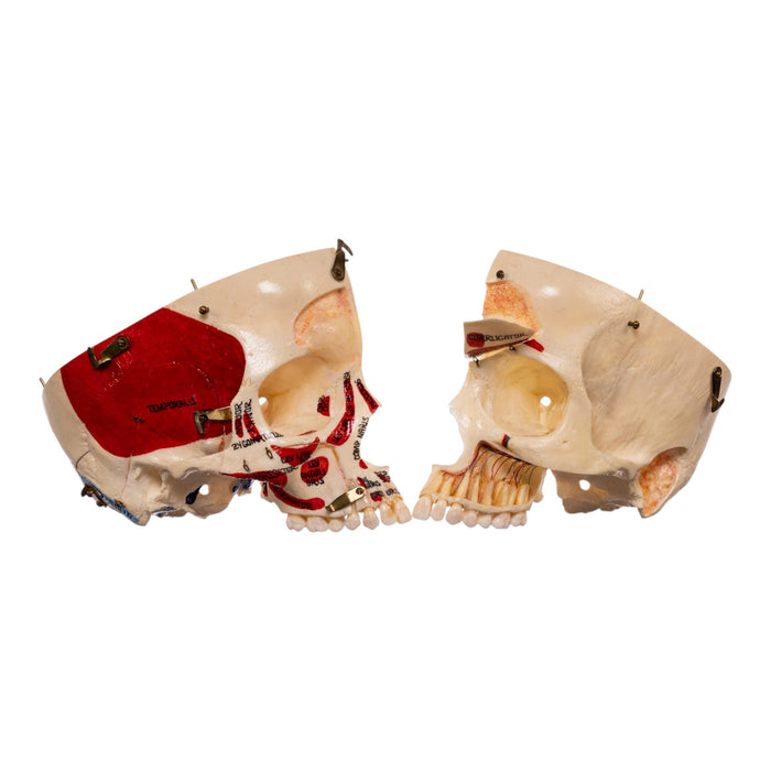 Real Human Dissected Skull in Carrying Case