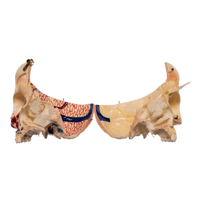 Real Human Dissected Skull in Carrying Case