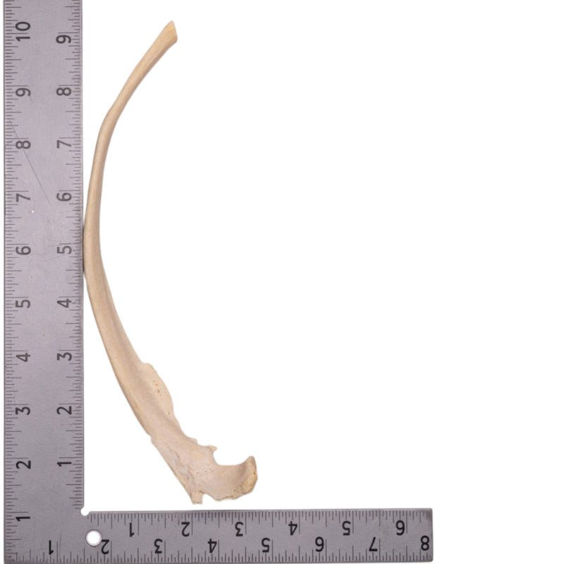 Real Human Rib - Pathology