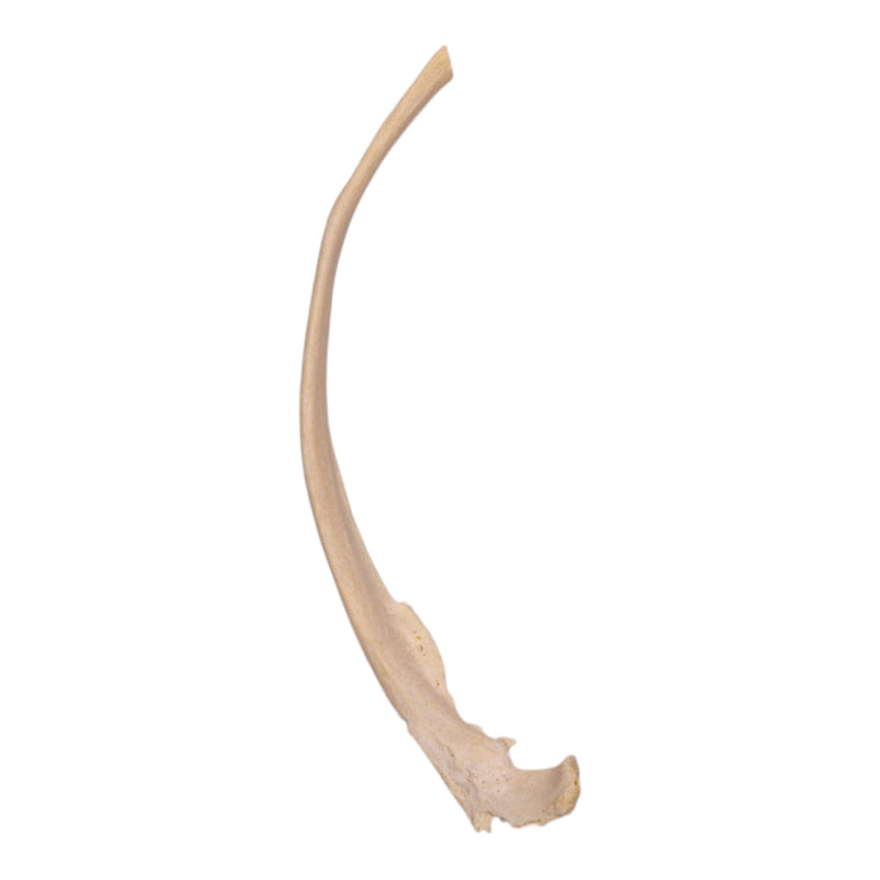 Real Human Rib - Pathology