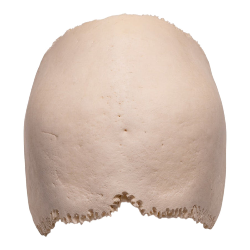 Real Human Partial Cranial Vault