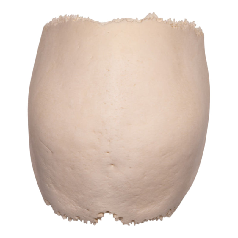 Real Human Partial Cranial Vault