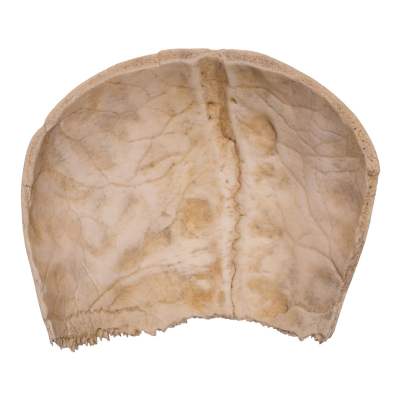 Real Human Partial Cranial Vault