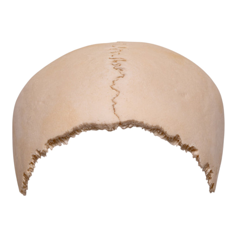 Real Human Partial Cranial Vault