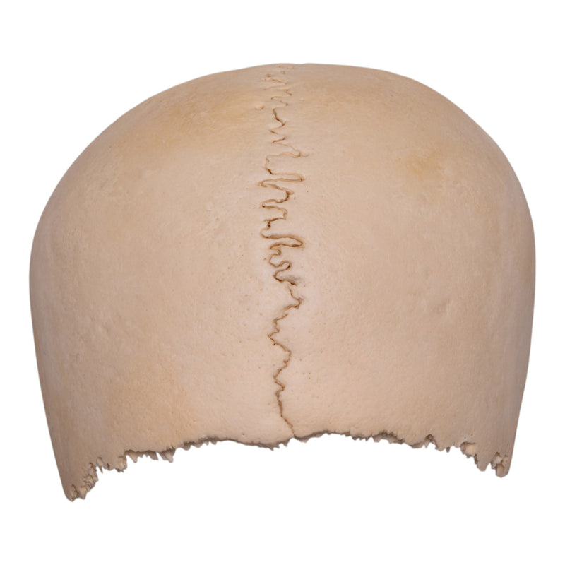 Real Human Partial Cranial Vault