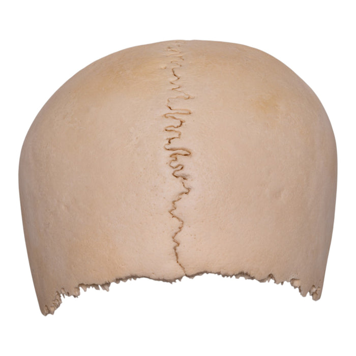 Real Human Partial Cranial Vault