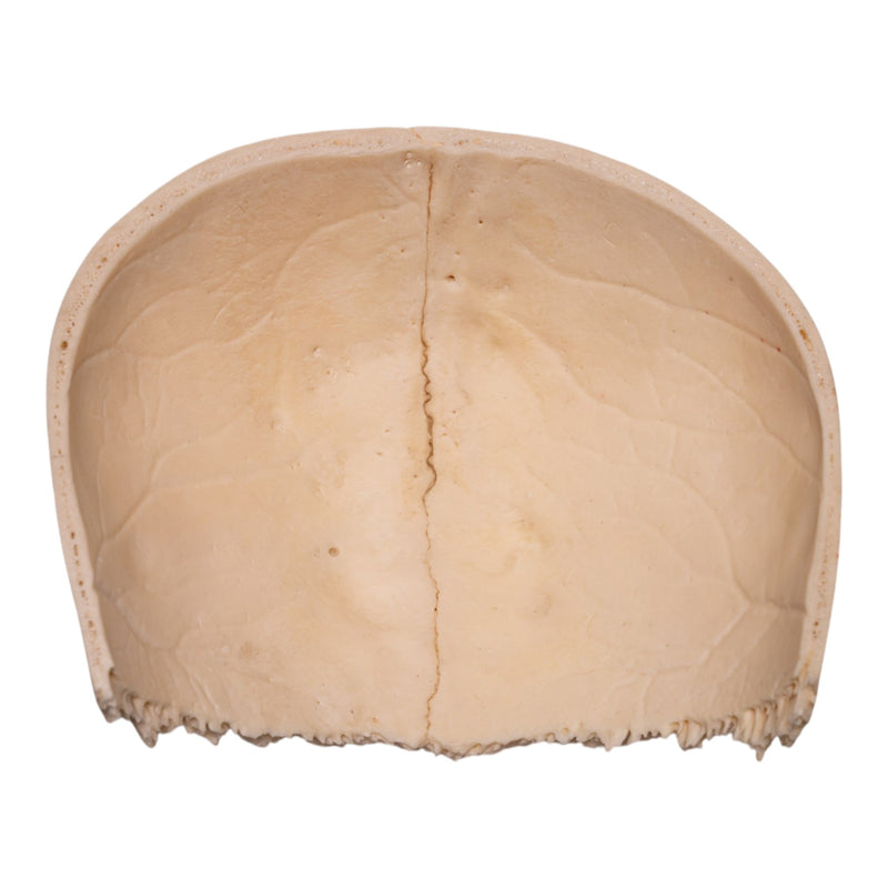 Real Human Partial Cranial Vault