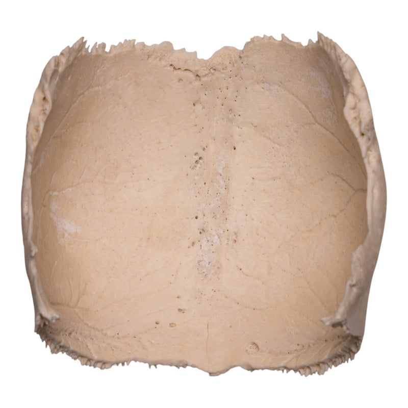 Real Human Partial Cranial Vault