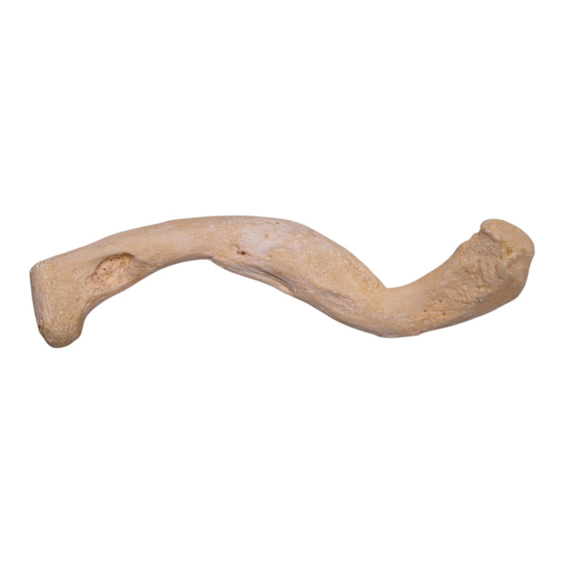 Real Human Clavicle - Pathology