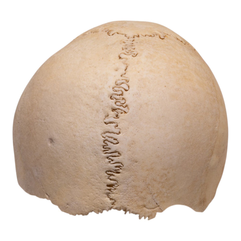 Real Human Partial Cranial Vault