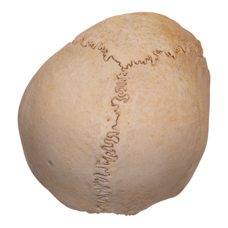Real Human Partial Cranial Vault