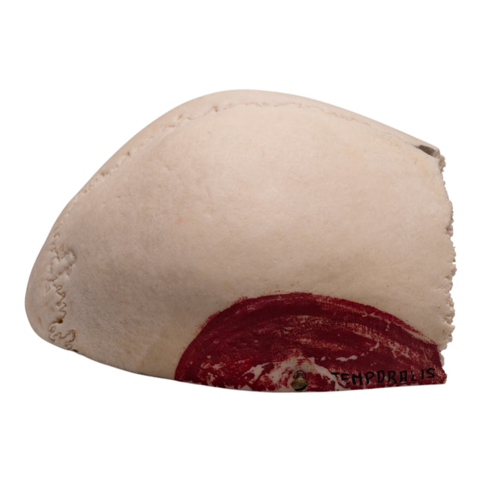 Real Human Partial Cranial Vault