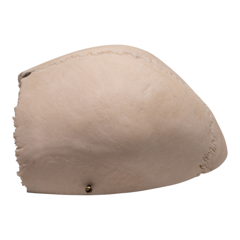 Real Human Partial Cranial Vault