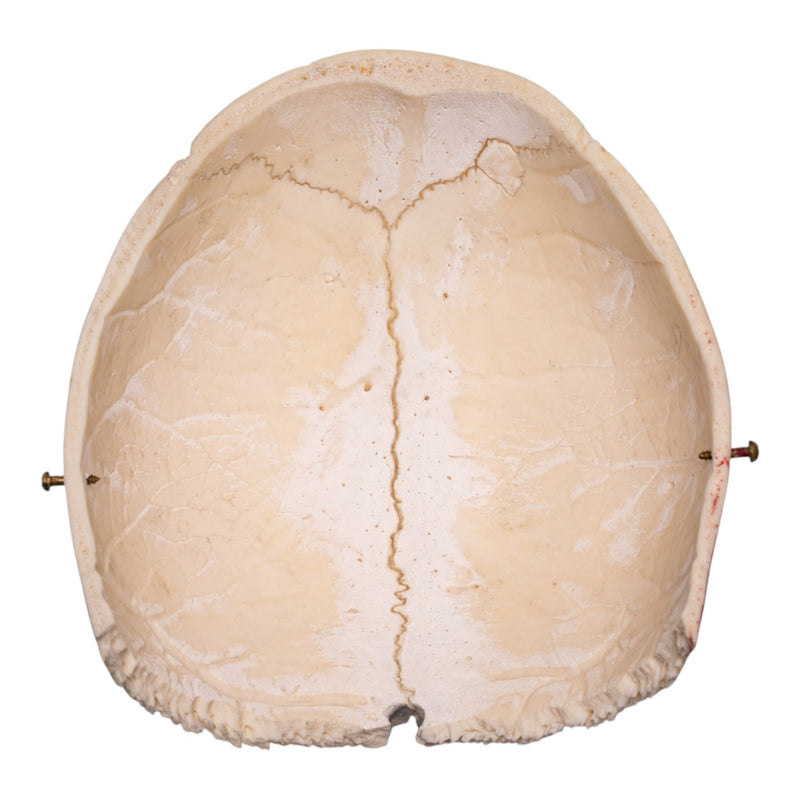 Real Human Partial Cranial Vault