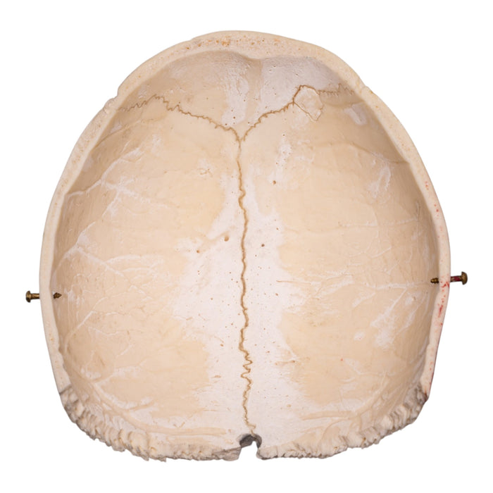 Real Human Partial Cranial Vault