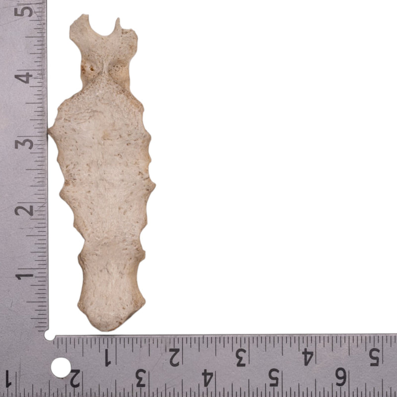 Real Human Partial Sternum