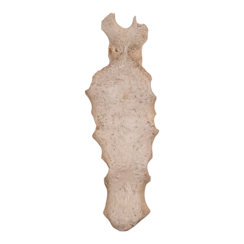 Real Human Partial Sternum