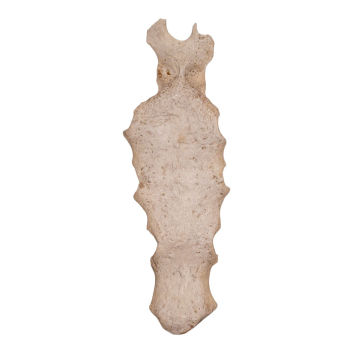 Real Human Partial Sternum