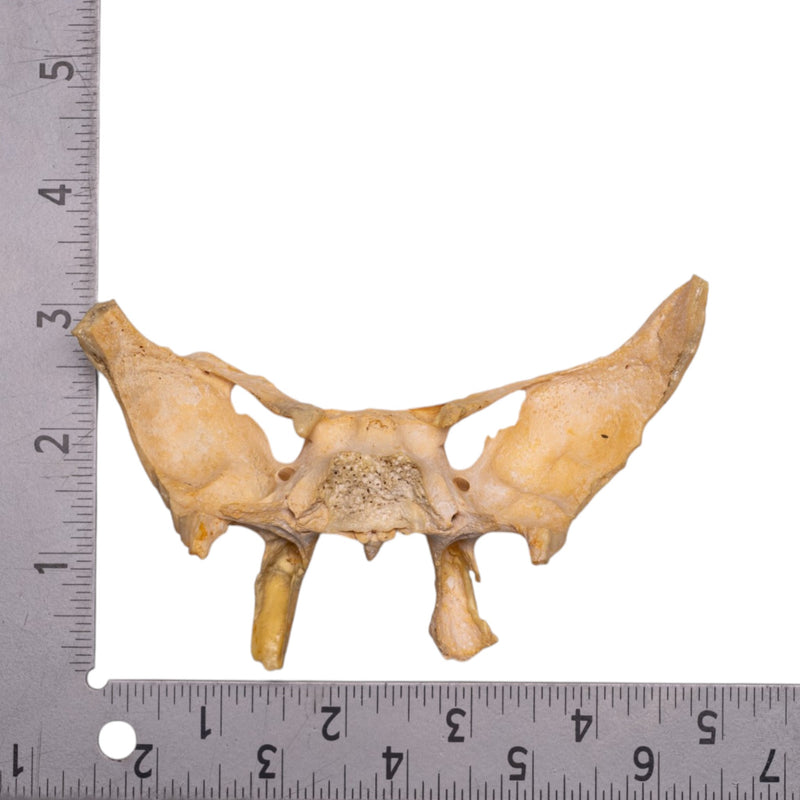 Real Human Sphenoid Bone