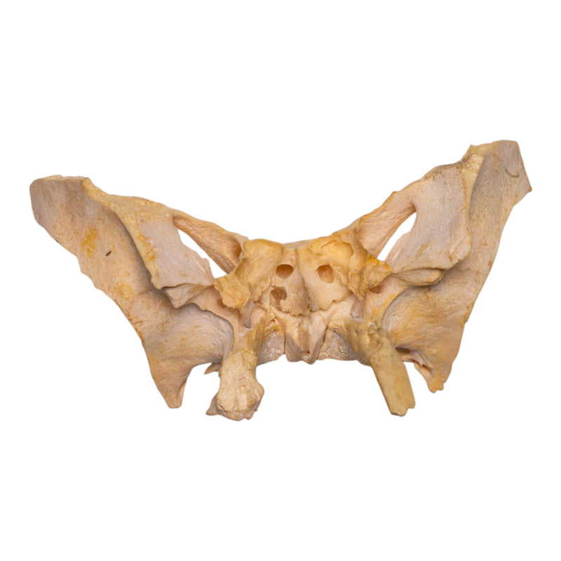 Real Human Sphenoid Bone