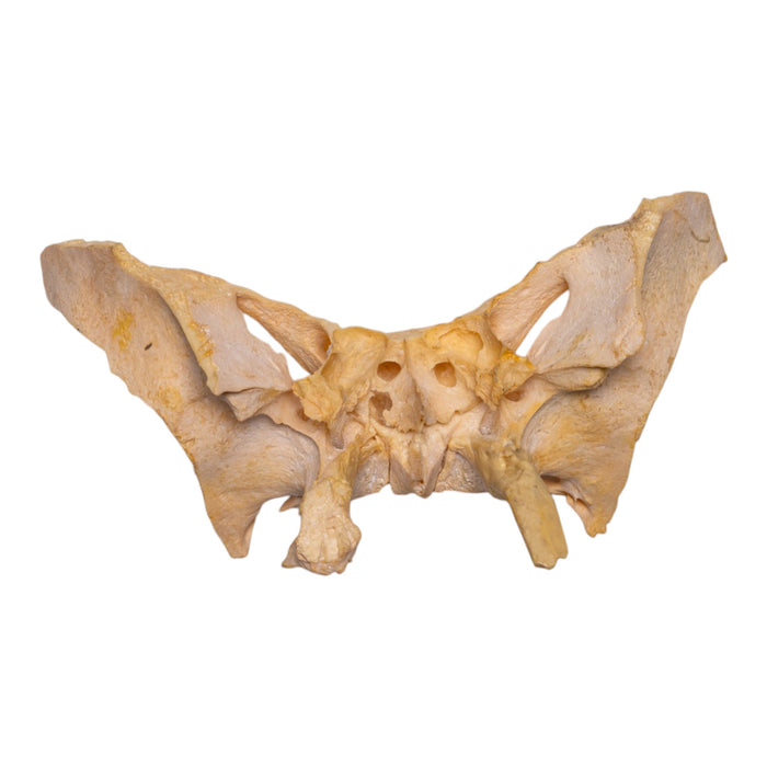 Real Human Sphenoid Bone