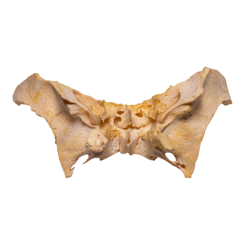 Real Human Sphenoid Bone