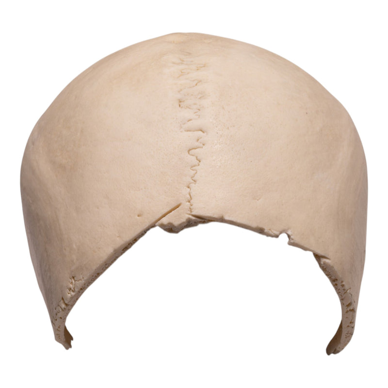 Real Human Partial Cranial Vault