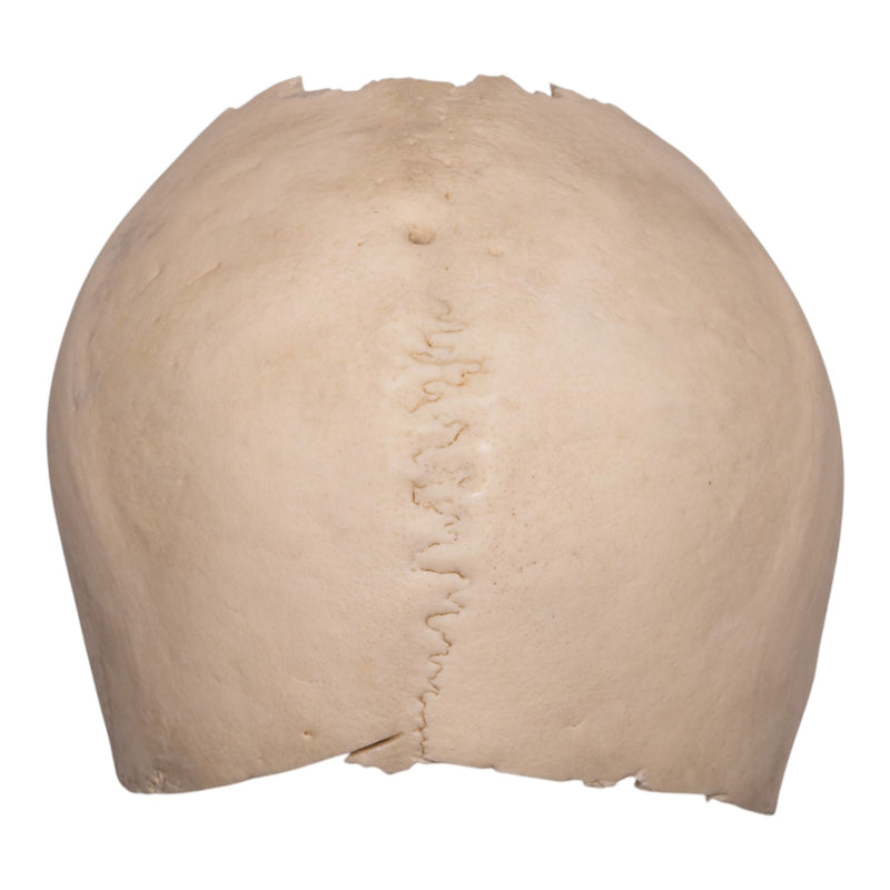 Real Human Partial Cranial Vault